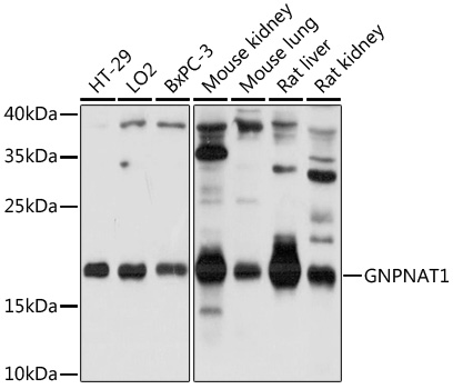 Western blot analysis of extracts of various cell lines, using GNPNAT1 antibody (TA376667) at 1:1000 dilution. - Secondary antibody: HRP Goat Anti-Rabbit IgG (H+L) at 1:10000 dilution. - Lysates/proteins: 25ug per lane. - Blocking buffer: 3% nonfat dry milk in TBST. - Detection: ECL Basic Kit . - Exposure time: 15s.