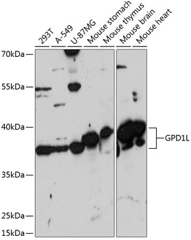 Western blot analysis of extracts of various cell lines, using GPD1L antibody (TA376703) at 1:3000 dilution. - Secondary antibody: HRP Goat Anti-Rabbit IgG (H+L) at 1:10000 dilution. - Lysates/proteins: 25ug per lane. - Blocking buffer: 3% nonfat dry milk in TBST. - Detection: ECL Basic Kit . - Exposure time: 90s.