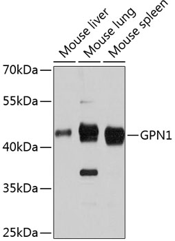 Western blot analysis of extracts of various cell lines, using GPN1 antibody (TA376716) at 1:3000 dilution. - Secondary antibody: HRP Goat Anti-Rabbit IgG (H+L) at 1:10000 dilution. - Lysates/proteins: 25ug per lane. - Blocking buffer: 3% nonfat dry milk in TBST. - Detection: ECL Basic Kit . - Exposure time: 90s.