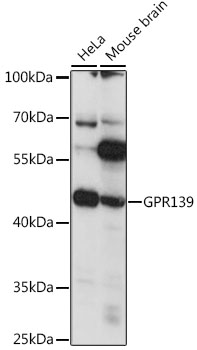 Western blot analysis of extracts of various cell lines, using GPR139 antibody (TA376723) at 1:1000 dilution. - Secondary antibody: HRP Goat Anti-Rabbit IgG (H+L) at 1:10000 dilution. - Lysates/proteins: 25ug per lane. - Blocking buffer: 3% nonfat dry milk in TBST. - Detection: ECL Basic Kit . - Exposure time: 10s.
