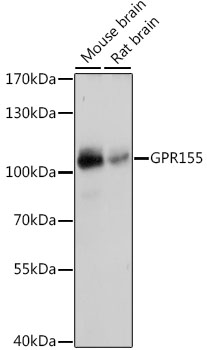 Western blot analysis of extracts of various cell lines, using GPR155 antibody (TA376729) at 1:1000 dilution. - Secondary antibody: HRP Goat Anti-Rabbit IgG (H+L) at 1:10000 dilution. - Lysates/proteins: 25ug per lane. - Blocking buffer: 3% nonfat dry milk in TBST. - Detection: ECL Basic Kit . - Exposure time: 5s.