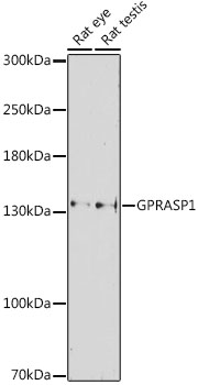 Western blot analysis of extracts of various cell lines, using GPRASP1 antibody (TA376749) at 1:1000 dilution. - Secondary antibody: HRP Goat Anti-Rabbit IgG (H+L) at 1:10000 dilution. - Lysates/proteins: 25ug per lane. - Blocking buffer: 3% nonfat dry milk in TBST. - Detection: ECL Basic Kit . - Exposure time: 90s.