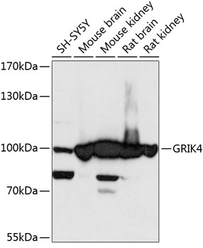Western blot analysis of extracts of various cell lines, using GRIK4 antibody (TA376778) at 1:3000 dilution. - Secondary antibody: HRP Goat Anti-Rabbit IgG (H+L) at 1:10000 dilution. - Lysates/proteins: 25ug per lane. - Blocking buffer: 3% nonfat dry milk in TBST. - Detection: ECL Basic Kit . - Exposure time: 10s.