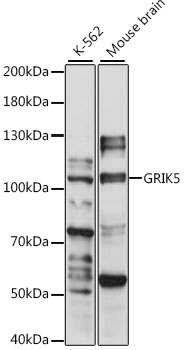 Western blot analysis of extracts of various cell lines, using GRIK5 antibody (TA376779) at 1:1000 dilution. - Secondary antibody: HRP Goat Anti-Rabbit IgG (H+L) at 1:10000 dilution. - Lysates/proteins: 25ug per lane. - Blocking buffer: 3% nonfat dry milk in TBST. - Detection: ECL Basic Kit . - Exposure time: 30s.