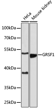 Western blot analysis of extracts of various cell lines, using GRSF1 antibody (TA376808) at 1:1000 dilution. - Secondary antibody: HRP Goat Anti-Rabbit IgG (H+L) at 1:10000 dilution. - Lysates/proteins: 25ug per lane. - Blocking buffer: 3% nonfat dry milk in TBST. - Detection: ECL Basic Kit . - Exposure time: 180s.
