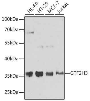 Western blot analysis of extracts of various cell lines, using GTF2H3 antibody (TA376856) at 1:1000 dilution. - Secondary antibody: HRP Goat Anti-Rabbit IgG (H+L) at 1:10000 dilution. - Lysates/proteins: 25ug per lane. - Blocking buffer: 3% nonfat dry milk in TBST. - Detection: ECL Basic Kit . - Exposure time: 10s.