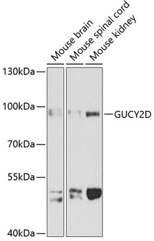 Western blot analysis of extracts of various cell lines, using GUCY2D antibody (TA376880) at 1:1000 dilution. - Secondary antibody: HRP Goat Anti-Rabbit IgG (H+L) at 1:10000 dilution. - Lysates/proteins: 25ug per lane. - Blocking buffer: 3% nonfat dry milk in TBST. - Detection: ECL Basic Kit . - Exposure time: 90s.