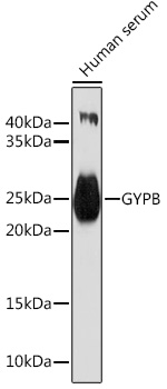 Western blot analysis of extracts of Human serum, using GYPB Rabbit pAb (TA376888) at 1:1000 dilution. - Secondary antibody: HRP Goat Anti-Rabbit IgG (H+L) at 1:10000 dilution. - Lysates/proteins: 25ug per lane. - Blocking buffer: 3% nonfat dry milk in TBST. - Detection: ECL Basic Kit . - Exposure time: 60s.
