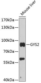 Western blot analysis of extracts of mouse liver, using GYS2 antibody (TA376891) at 1:3000 dilution. - Secondary antibody: HRP Goat Anti-Rabbit IgG (H+L) at 1:10000 dilution. - Lysates/proteins: 25ug per lane. - Blocking buffer: 3% nonfat dry milk in TBST. - Detection: ECL Basic Kit . - Exposure time: 30s.