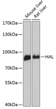 Western blot analysis of extracts of various cell lines, using HAL antibody (TA376914) at 1:3000 dilution. - Secondary antibody: HRP Goat Anti-Rabbit IgG (H+L) at 1:10000 dilution. - Lysates/proteins: 25ug per lane. - Blocking buffer: 3% nonfat dry milk in TBST. - Detection: ECL Enhanced Kit . - Exposure time: 90s.