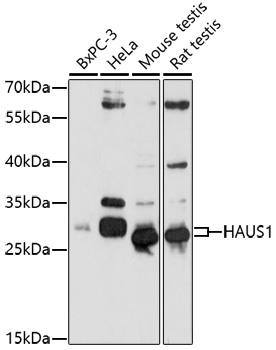 Western blot analysis of extracts of various cell lines, using HAUS1 antibody (TA376928) at 1:1000 dilution. - Secondary antibody: HRP Goat Anti-Rabbit IgG (H+L) at 1:10000 dilution. - Lysates/proteins: 25ug per lane. - Blocking buffer: 3% nonfat dry milk in TBST. - Detection: ECL Basic Kit . - Exposure time: 90s.