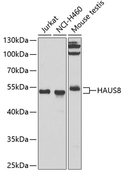 Western blot analysis of extracts of various cell lines, using HAUS8 antibody (TA376930) at 1:1000 dilution. - Secondary antibody: HRP Goat Anti-Rabbit IgG (H+L) at 1:10000 dilution. - Lysates/proteins: 25ug per lane. - Blocking buffer: 3% nonfat dry milk in TBST. - Detection: ECL Basic Kit . - Exposure time: 90s.