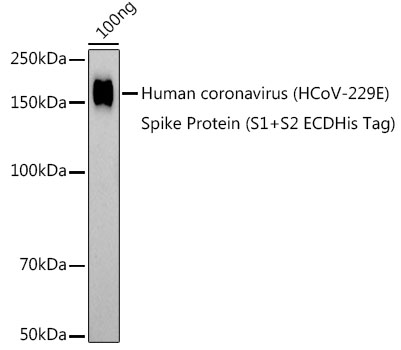 Western blot analysis of extracts of Human coronavirus (HCoV-229E) Spike Protein (S1+S2 ECDHis Tag), using HCoV-229E Spike S1 antibody (TA376958) at 1:1000 dilution. - Secondary antibody: HRP Goat Anti-Rabbit IgG (H+L) at 1:10000 dilution. - Lysates/proteins: 25ug per lane. - Blocking buffer: 3% nonfat dry milk in TBST. - Detection: ECL Basic Kit . - Exposure time: 180s.