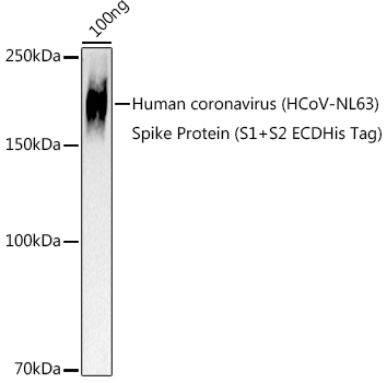 Western blot analysis of extracts of Human coronavirus (HCoV-NL63) Spike Protein (S1+S2 ECDHis Tag), using HCoV-NL63 Spike S2 antibody (TA376963) at 1:1000 dilution. - Secondary antibody: HRP Goat Anti-Rabbit IgG (H+L) at 1:10000 dilution. - Lysates/proteins: 25ug per lane. - Blocking buffer: 3% nonfat dry milk in TBST. - Detection: ECL Basic Kit . - Exposure time: 90s.