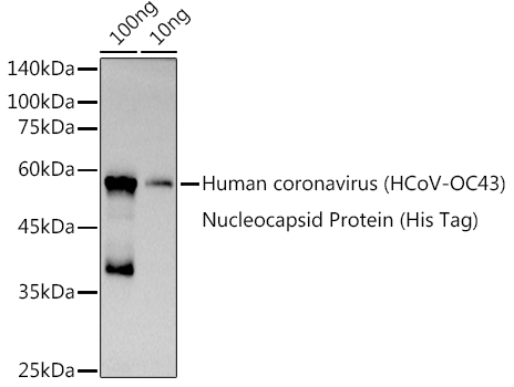 Western blot analysis of extracts of Human coronavirus (HCoV-OC43) Nucleocapsid Protein (His Tag), using HCoV-OC43 Nucleoprotein antibody (TA376964) at 1:1000 dilution. - Secondary antibody: HRP Goat Anti-Rabbit IgG (H+L) at 1:10000 dilution. - Lysates/proteins: 25ug per lane. - Blocking buffer: 3% nonfat dry milk in TBST. - Detection: ECL Basic Kit . - Exposure time: 10s.