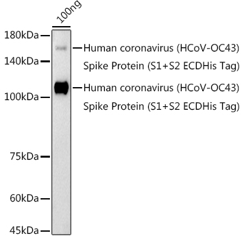 Western blot analysis of extracts of Human coronavirus (HCoV-OC43) Spike Protein (S1+S2 ECDHis Tag), using HCoV-OC43 Spike S1 antibody (TA376965) at 1:1000 dilution. - Secondary antibody: HRP Goat Anti-Rabbit IgG (H+L) at 1:10000 dilution. - Lysates/proteins: 25ug per lane. - Blocking buffer: 3% nonfat dry milk in TBST. - Detection: ECL Enhanced Kit . - Exposure time: 180s.
