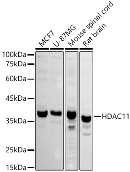 PGII Luminex with 1H5 Capture (TA809141) and 3C2 Detection (TA809534) Antibodies. Substrate used: recombinant protein expressed in E.coli corresponding to amino acids 17-388 of human pepsinogen C (PG II).