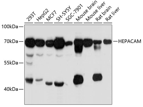Western blot analysis of extracts of various cell lines, using HEPACAM antibody (TA376994) at 1:3000 dilution. - Secondary antibody: HRP Goat Anti-Rabbit IgG (H+L) at 1:10000 dilution. - Lysates/proteins: 25ug per lane. - Blocking buffer: 3% nonfat dry milk in TBST. - Detection: ECL Basic Kit . - Exposure time: 10s.