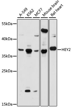 Western blot analysis of extracts of various cell lines, using HEY2 antibody (TA377006) at 1:1000 dilution. - Secondary antibody: HRP Goat Anti-Rabbit IgG (H+L) at 1:10000 dilution. - Lysates/proteins: 25ug per lane. - Blocking buffer: 3% nonfat dry milk in TBST. - Detection: ECL Basic Kit . - Exposure time: 60s.