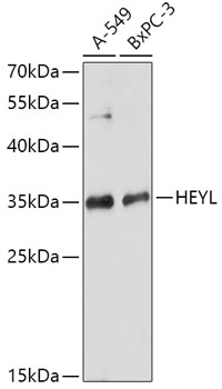 Western blot analysis of extracts of various cell lines, using HEYL antibody (TA377007) at 1:1000 dilution. - Secondary antibody: HRP Goat Anti-Rabbit IgG (H+L) at 1:10000 dilution. - Lysates/proteins: 25ug per lane. - Blocking buffer: 3% nonfat dry milk in TBST. - Detection: ECL Basic Kit . - Exposure time: 90s.