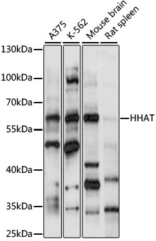 Western blot analysis of extracts of various cell lines, using HHAT antibody (TA377013) at 1:1000 dilution. - Secondary antibody: HRP Goat Anti-Rabbit IgG (H+L) at 1:10000 dilution. - Lysates/proteins: 25ug per lane. - Blocking buffer: 3% nonfat dry milk in TBST. - Detection: ECL Basic Kit . - Exposure time: 60s.
