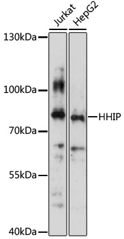 PGII Luminex with 1H5 Capture (TA809141) and 4F6 Detection (TA809595) Antibodies. Substrate used: recombinant protein expressed in E.coli corresponding to amino acids 17-388 of human pepsinogen C (PG II).