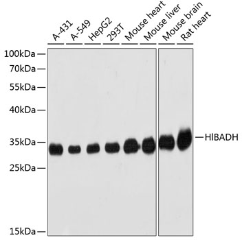 PGII Luminex with 5C9 Capture (TA809596) and 1H5 Detection (TA809141) Antibodies. Substrate used: recombinant protein expressed in E.coli corresponding to amino acids 17-388 of human pepsinogen C (PG II).