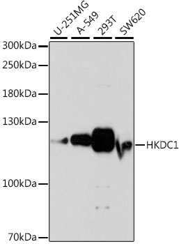 HEK293T cells were transfected with the pCMV6-ENTRY control (Left lane) or pCMV6-ENTRY SH3BGRL (RC204993, Right lane) cDNA for 48 hrs and lysed. Equivalent amounts of cell lysates (5 ug per lane) were separated by SDS-PAGE and immunoblotted with anti-SH3BGRL (1:2000). Positive lysates LY418952 (100 ug) and LC418952 (20 ug) can be purchased separately from OriGene.