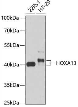 Western blot analysis of extracts of various cell lines, using HOXA13 antibody (TA377181) at 1:1000 dilution. - Secondary antibody: HRP Goat Anti-Rabbit IgG (H+L) at 1:10000 dilution. - Lysates/proteins: 25ug per lane. - Blocking buffer: 3% nonfat dry milk in TBST. - Detection: ECL Basic Kit . - Exposure time: 30s.