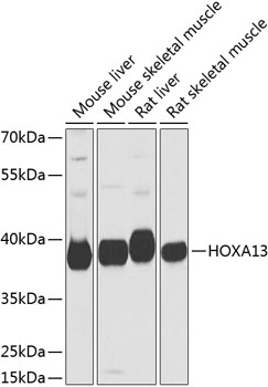 Western blot analysis of extracts of various cell lines, using HOXA13 antibody (TA377182) at 1:1000 dilution. - Secondary antibody: HRP Goat Anti-Rabbit IgG (H+L) at 1:10000 dilution. - Lysates/proteins: 25ug per lane. - Blocking buffer: 3% nonfat dry milk in TBST. - Detection: ECL Basic Kit . - Exposure time: 10s.