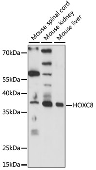 Western blot analysis of extracts of various cell lines, using HOXC8 antibody (TA377197) at 1:1000 dilution. - Secondary antibody: HRP Goat Anti-Rabbit IgG (H+L) at 1:10000 dilution. - Lysates/proteins: 25ug per lane. - Blocking buffer: 3% nonfat dry milk in TBST. - Detection: ECL Basic Kit . - Exposure time: 1s.