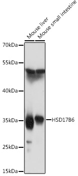 Western blot analysis of extracts of various cell lines, using HSD17B6 antibody (TA377236) at 1:1000 dilution. - Secondary antibody: HRP Goat Anti-Rabbit IgG (H+L) at 1:10000 dilution. - Lysates/proteins: 25ug per lane. - Blocking buffer: 3% nonfat dry milk in TBST. - Detection: ECL Basic Kit . - Exposure time: 90s.