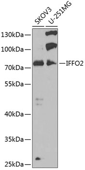 Western blot analysis of extracts of various cell lines, using IFFO2 antibody (TA377331) at 1:1000 dilution. - Secondary antibody: HRP Goat Anti-Rabbit IgG (H+L) at 1:10000 dilution. - Lysates/proteins: 25ug per lane. - Blocking buffer: 3% nonfat dry milk in TBST. - Detection: ECL Basic Kit . - Exposure time: 90s.