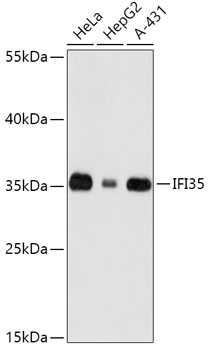 HEK293T cells were transfected with the pCMV6-ENTRY control (Left lane) or pCMV6-ENTRY WHSC1L1 (RC212790, Right lane) cDNA for 48 hrs and lysed. Equivalent amounts of cell lysates (5 ug per lane) were separated by SDS-PAGE and immunoblotted with anti-WHSC1L1 (1:2000). Positive lysates LY413551 (100 ug) and LC413551 (20 ug) can be purchased separately from OriGene.