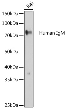 Western blot analysis of extracts of Raji cells, using Human IgM antibody (TA377394) at 1:500 dilution. - Secondary antibody: HRP Goat Anti-Rabbit IgG (H+L) at 1:10000 dilution. - Lysates/proteins: 25ug per lane. - Blocking buffer: 3% nonfat dry milk in TBST. - Detection: ECL Basic Kit . - Exposure time: 30s.