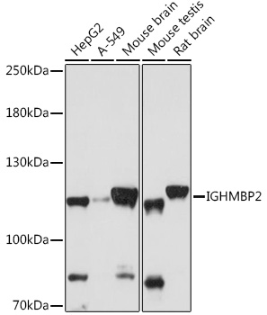 Western blot analysis of extracts of various cell lines, using IGHMBP2 antibody (TA377395) at 1:1000 dilution. - Secondary antibody: HRP Goat Anti-Rabbit IgG (H+L) at 1:10000 dilution. - Lysates/proteins: 25ug per lane. - Blocking buffer: 3% nonfat dry milk in TBST. - Detection: ECL Basic Kit . - Exposure time: 60s.