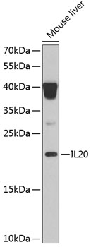 HEK293T cells were transfected with the pCMV6-ENTRY control (Cat# PS100001, Left lane) or pCMV6-ENTRY SEC23B (Cat# RC210572, Right lane) cDNA for 48 hrs and lysed. Equivalent amounts of cell lysates (5 ug per lane) were separated by SDS-PAGE and immunoblotted with anti-SEC23B (Cat# TA810159)(1:2000). Positive lysates [LY403219] (100 ug) and [LC403219] (20 ug) can be purchased separately from OriGene.