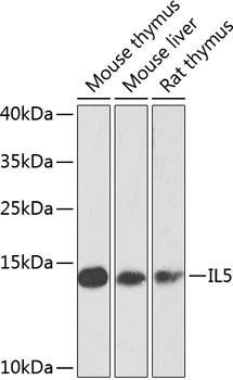 HEK293T cells were transfected with the pCMV6-ENTRY control (Cat# PS100001, Left lane) or pCMV6-ENTRY SLC22A17 (Cat# RC214220, Right lane) cDNA for 48 hrs and lysed. Equivalent amounts of cell lysates (5 ug per lane) were separated by SDS-PAGE and immunoblotted with anti-SLC22A17 (Cat# TA810195)(1:500). Positive lysates [LY413864] (100 ug) and [LC413864] (20 ug) can be purchased separately from OriGene.