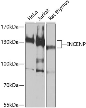 Western blot analysis of extracts of various cell lines, using INCENP antibody (TA377502) at 1:1000 dilution. - Secondary antibody: HRP Goat Anti-Rabbit IgG (H+L) at 1:10000 dilution. - Lysates/proteins: 25ug per lane. - Blocking buffer: 3% nonfat dry milk in TBST. - Detection: ECL Basic Kit . - Exposure time: 30s.