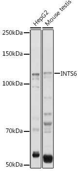 Western blot analysis of extracts of various cell lines, using INTS6 antibody (TA377536) at 1:1000 dilution. - Secondary antibody: HRP Goat Anti-Rabbit IgG (H+L) at 1:10000 dilution. - Lysates/proteins: 25ug per lane. - Blocking buffer: 3% nonfat dry milk in TBST. - Detection: ECL Basic Kit . - Exposure time: 1s.