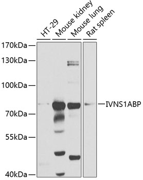 Western blot analysis of extracts of various cell lines, using IVNS1ABP antibody (TA377637) at 1:1000 dilution. - Secondary antibody: HRP Goat Anti-Rabbit IgG (H+L) at 1:10000 dilution. - Lysates/proteins: 25ug per lane. - Blocking buffer: 3% nonfat dry milk in TBST. - Detection: ECL Basic Kit . - Exposure time: 30s.