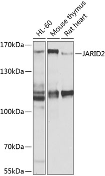 Western blot analysis of extracts of various cell lines, using JARID2 antibody (TA377657) at 1:1000 dilution. - Secondary antibody: HRP Goat Anti-Rabbit IgG (H+L) at 1:10000 dilution. - Lysates/proteins: 25ug per lane. - Blocking buffer: 3% nonfat dry milk in TBST. - Detection: ECL Basic Kit . - Exposure time: 10s.