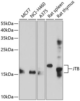 Western blot analysis of extracts of various cell lines, using JTB antibody (TA377666) at 1:1000 dilution. - Secondary antibody: HRP Goat Anti-Rabbit IgG (H+L) at 1:10000 dilution. - Lysates/proteins: 25ug per lane. - Blocking buffer: 3% nonfat dry milk in TBST. - Detection: ECL Enhanced Kit . - Exposure time: 60s.