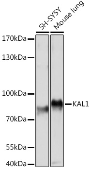 Western blot analysis of extracts of various cell lines, using KAL1 Rabbit pAb (TA377677) at 1:1000 dilution. - Secondary antibody: HRP Goat Anti-Rabbit IgG (H+L) at 1:10000 dilution. - Lysates/proteins: 25ug per lane. - Blocking buffer: 3% nonfat dry milk in TBST. - Detection: ECL Basic Kit . - Exposure time: 5s.