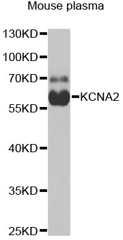 Western blot analysis of extracts of mouse plasma, using KCNA2 antibody (TA377693) at 1:1000 dilution. - Secondary antibody: HRP Goat Anti-Rabbit IgG (H+L) at 1:10000 dilution. - Lysates/proteins: 25ug per lane. - Blocking buffer: 3% nonfat dry milk in TBST. - Detection: ECL Basic Kit . - Exposure time: 90s.