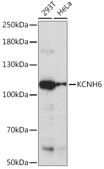 Western blot analysis of extracts of various cell lines, using KCNH6 Rabbit pAb (TA377709) at 1:1000 dilution. - Secondary antibody: HRP Goat Anti-Rabbit IgG (H+L) at 1:10000 dilution. - Lysates/proteins: 25ug per lane. - Blocking buffer: 3% nonfat dry milk in TBST. - Detection: ECL Enhanced Kit . - Exposure time: 60s.
