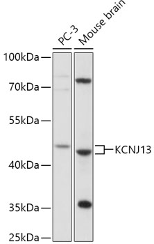 Western blot analysis of extracts of various cell lines, using KCNJ13 antibody (TA377717) at 1:1000 dilution. - Secondary antibody: HRP Goat Anti-Rabbit IgG (H+L) at 1:10000 dilution. - Lysates/proteins: 25ug per lane. - Blocking buffer: 3% nonfat dry milk in TBST. - Detection: ECL Basic Kit . - Exposure time: 2min.