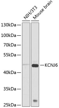 Western blot analysis of extracts of various cell lines, using KCNJ6 antibody (TA377726) at 1:1000 dilution. - Secondary antibody: HRP Goat Anti-Rabbit IgG (H+L) at 1:10000 dilution. - Lysates/proteins: 25ug per lane. - Blocking buffer: 3% nonfat dry milk in TBST. - Detection: ECL Basic Kit . - Exposure time: 30s.