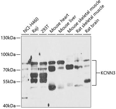 Western blot analysis of extracts of various cell lines, using KCNN3 antibody (TA377739) at 1:1000 dilution. - Secondary antibody: HRP Goat Anti-Rabbit IgG (H+L) at 1:10000 dilution. - Lysates/proteins: 25ug per lane. - Blocking buffer: 3% nonfat dry milk in TBST. - Detection: ECL Enhanced Kit . - Exposure time: 60s.