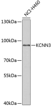 Western blot analysis of extracts of NCI-H460 cells, using KCNN3 antibody (TA377740) at 1:1000 dilution. - Secondary antibody: HRP Goat Anti-Rabbit IgG (H+L) at 1:10000 dilution. - Lysates/proteins: 25ug per lane. - Blocking buffer: 3% nonfat dry milk in TBST. - Detection: ECL Enhanced Kit . - Exposure time: 60s.